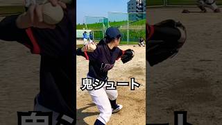 魔球シュートを投げる慶應大学院卒ナース #shorts
