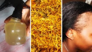 How I use Calendula RICE WATER to stop my thinning hair FAST | Rice water for hair growth