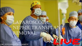 Lap. nephr transplant removal LIVE / Лап. удаление трансплантированной нефукционирующей почки
