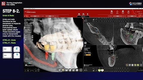 [EN] R2GATE Stand Alone update: Step 8-2. Un-DO & Re-DO