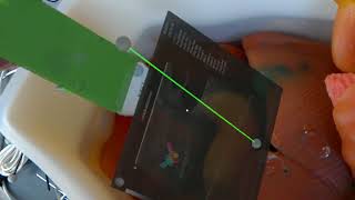 HoloLens real-time ultrasound feed and IRE needle guides