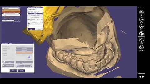 How to align Bite Rim in Exocad (2018)