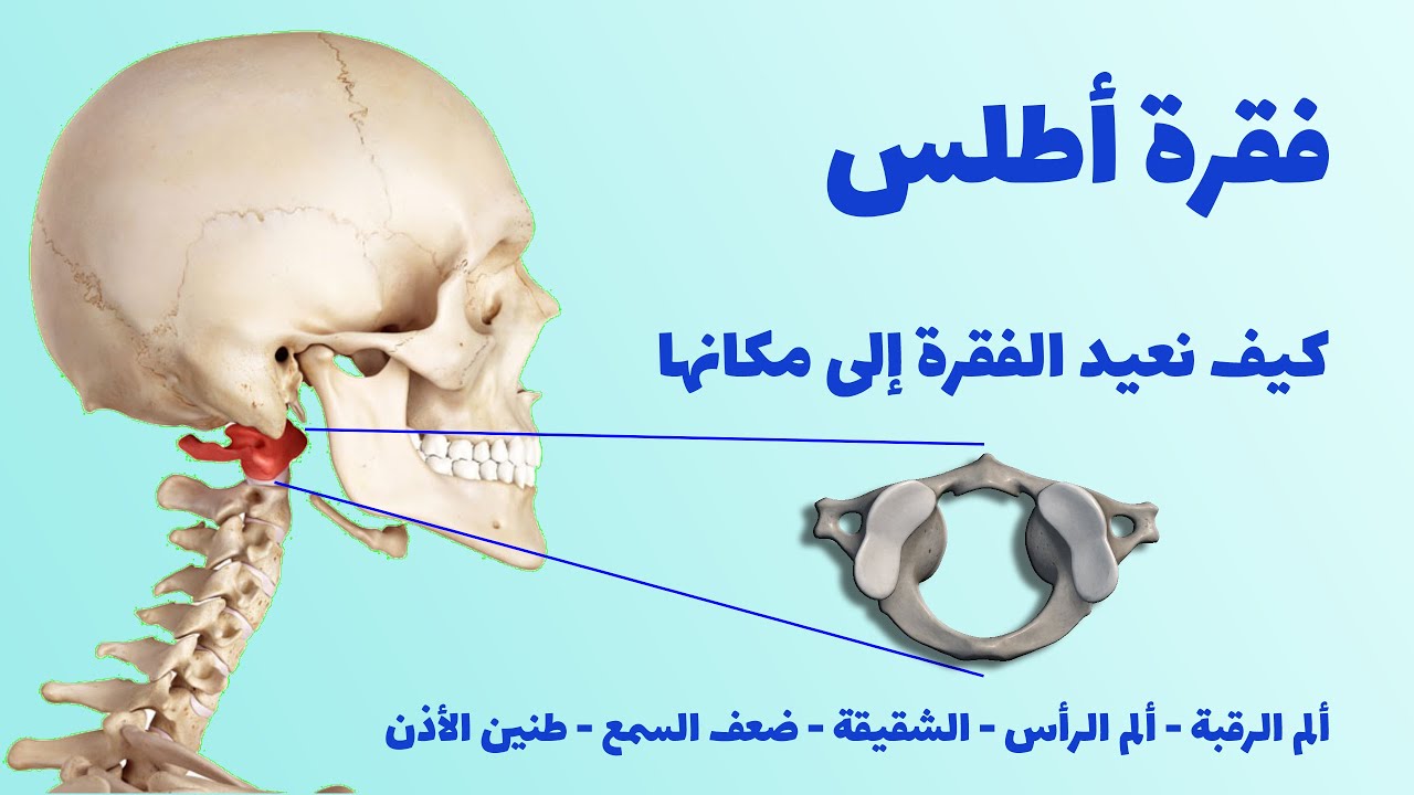 فقرة اطلس اولى الفقرات العنقية و حاملة الرأس - تمرين واحد لإعادة الفقرة و تفادي التبعات