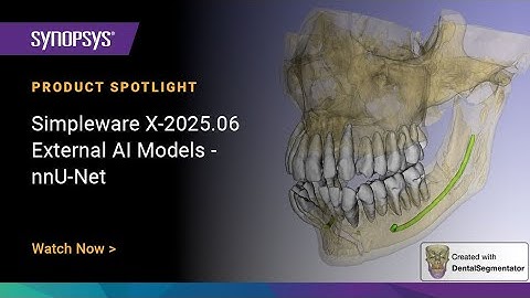Simpleware X-2025.06 - External AI Models: nnU-Net