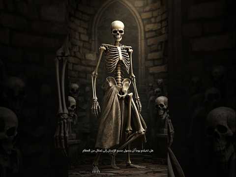 متلازمة الرجل المتحجر اكسبلور