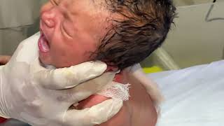 NICU Baby Feeding Time Protocol ❤️ | Safe Newborn Feeding Care #cute #baby #neonatologist #babycare 