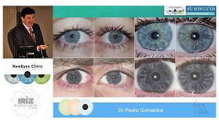 Eyes color change | Eyecos Meeting Barcelona 2019 by Dr Grimaldos