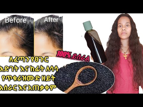 ቪዲዮ: በልጅ ላይ የፀጉር እድገት እንዴት እንደሚፋጠን