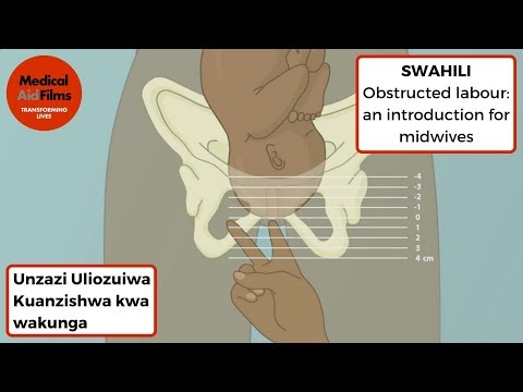 Video: Kuanzishwa Kwa Kiume