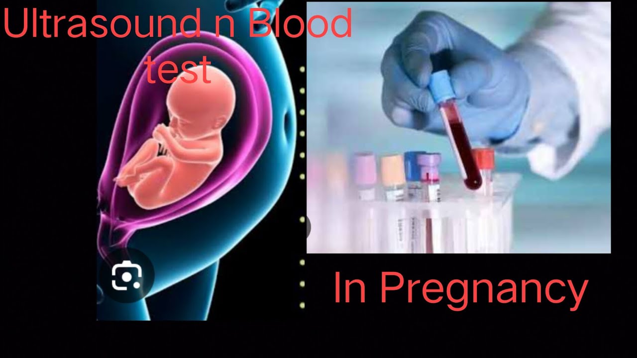 pregnancy me sonography aur blood test kab karna h aur konsa karna jaruri hRoutine tests YouTube
