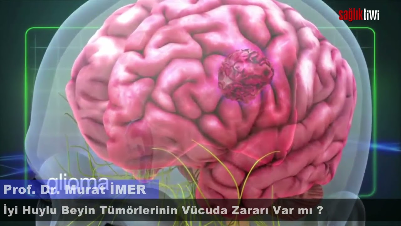 İyi Huylu Beyin Tümörlerinin Vücuda Zararı Var mı?