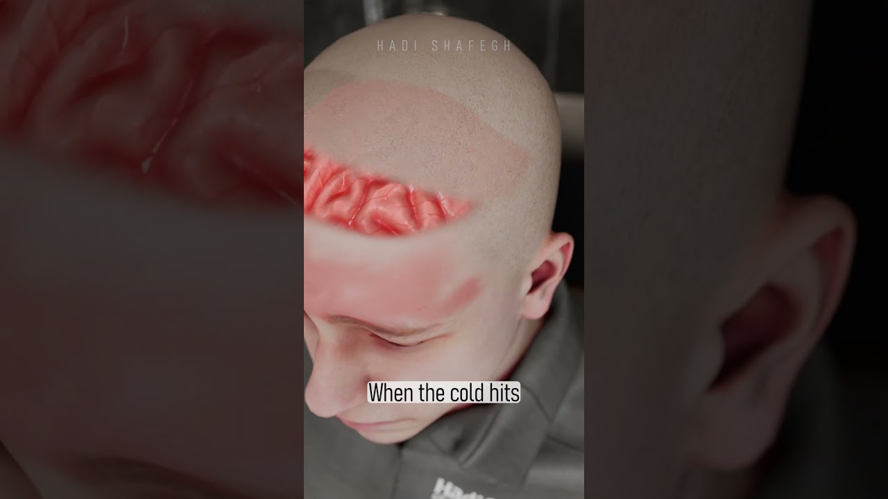 ​Instant Headache Relief? 🧊 The 3-Second Ice Cube Hack to Freeze Your Pain!