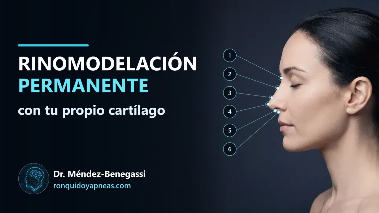 Permanent nose filler with your own cartilage, explained by Dr. Méndez-Benegassi