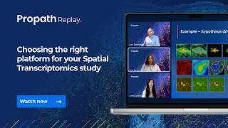 Spatial transcriptomics: Selecting the right platform for your study.