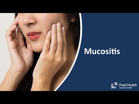 Mucositis: During and After Cancer Treatment