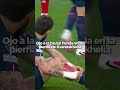 ¡Madre mía! la herida de Kvaratskhelia #shorts