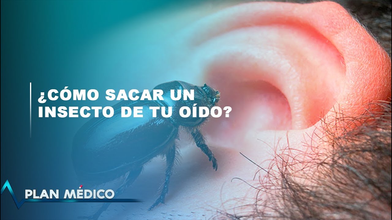 Cómo sacar un insecto de tu oído? | Plan Médico - YouTube