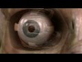 El sentido de la Vista - Cuerpo humano al limite