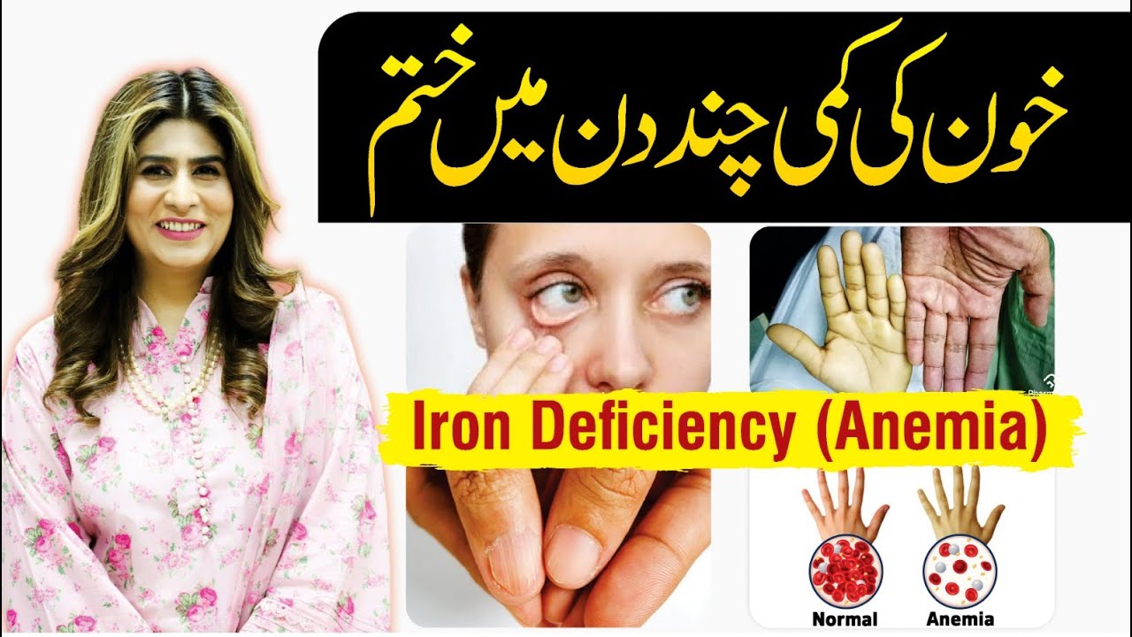 Iron Deficiency Treatment Anemia Kya Hota Hai Dr Fareeha Tariq