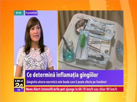 Video: De Ce Se Rănesc Gingiile Mele? Motivele și Tratamentul Durerii Gingivale