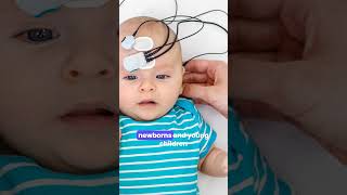 Otoacoustic Emissions Oae