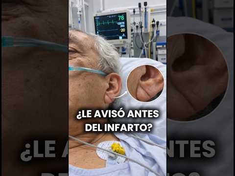 ¿Este pliegue en su oreja pudo advertirle del riesgo de sufrir un infarto?. #medicina #shorts