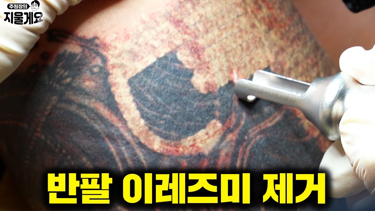 보디빌더 김강민 선수를 보고 문신 제거를 결심한 사연ㅣ문신제거ep.20 [주원장의 지울게요]