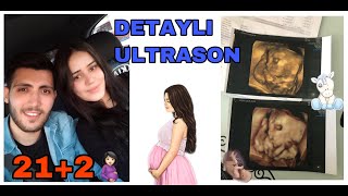 HAMİLEYİMM ?|| Gebelikte 21.hafta 21+2 | Detaylı ultrason ? |#baby #gebeliktakibi #cinsiyet