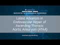 Episode 5 | Latest Advances in Endovascular Repair of Ascending Thoracic Aortic Aneurysm (ATAA)