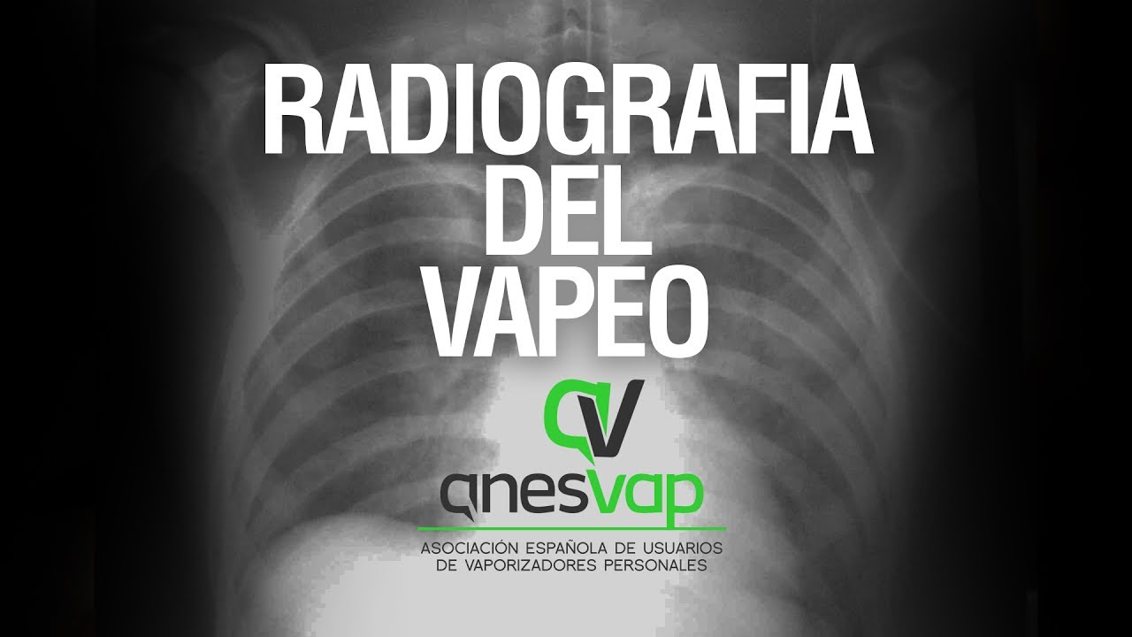 Radiografia del Vapeo – RESULTADOS DE LA ENCUESTA / LTDM cap. 76