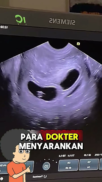 Ibu Ini Rela Kesulitan Demi Bayi Kembar 3 nya #shortsfeed #shortsviral #shortvideo #respectreaction