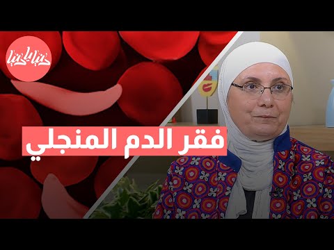 كيف يؤثر فقر الدم المنجلي على جودة الحياة وما أفضل العلاجات