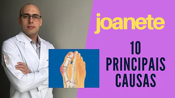 Qual o remédio caseiro para joanete?