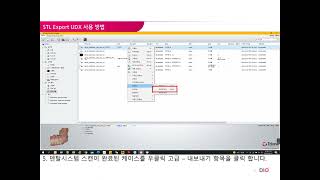 DIO Dental System STL Export UDX 사용 방법