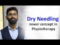 Dry needling  newer concept in physiotherapy  dr urvish patel physiotherapist