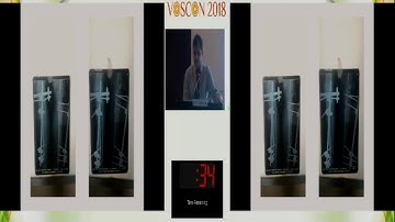 A Novel Technique for Treating infected non union of long bones -  Dr. Alok