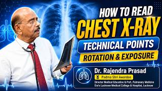 How to Read Chest X Ray | Technical Points | Rotation &amp; Exposure | Prof. (Dr.) Rajendra Prasad