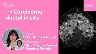 Carcinoma ductal in situ por la Dra. Mónica Huerta.