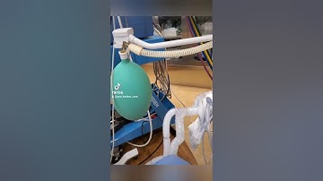 Day in life CRNA- Obstetrics