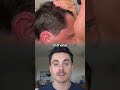 "Let's talk Topical Anti-Androgens - the game-changer in hair loss you need to know about 🧪