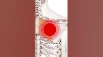 The Rhomboids Trigger Points