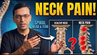 Your Phone is Destroying Your Neck 📱⚠️ | Here’s Why!