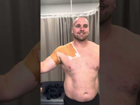 Posterior Shoulder Instability Taping