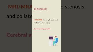 Moyamoya disease in 15 seconds  #medicine #mrcp