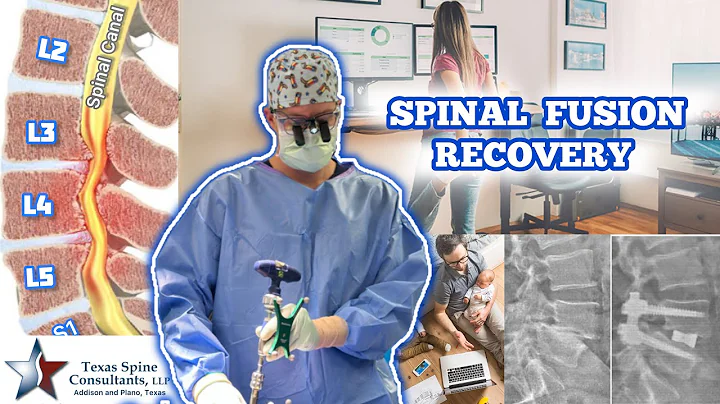 Spinal Fusion Recovery, EXPECTATIONS 🧗‍♀️🏨🏌️🏆