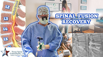 Spinal Fusion Recovery, EXPECTATIONS 🧗‍♀️🏨🏌️🏆