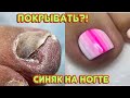 СИНЯК на ногте, покрывать? 🙄 Педикюр / Наращивание на ногах