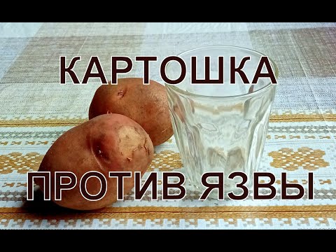 Картофельный сок при язве желудка и двенадцатиперстной кишки. Сезонное обострение язвы желудка.