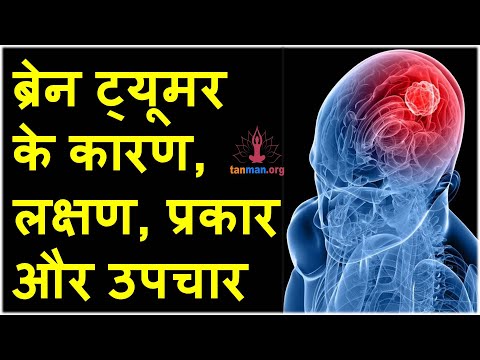ब्रेन ट्यूमर के लक्षण, कारण और उपचार | brain tumor ke lakshan | brain tumor symptoms in hindi