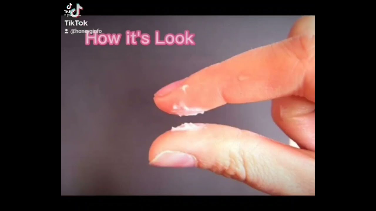 Treatment of lecoria in women causes symptoms and treatment 